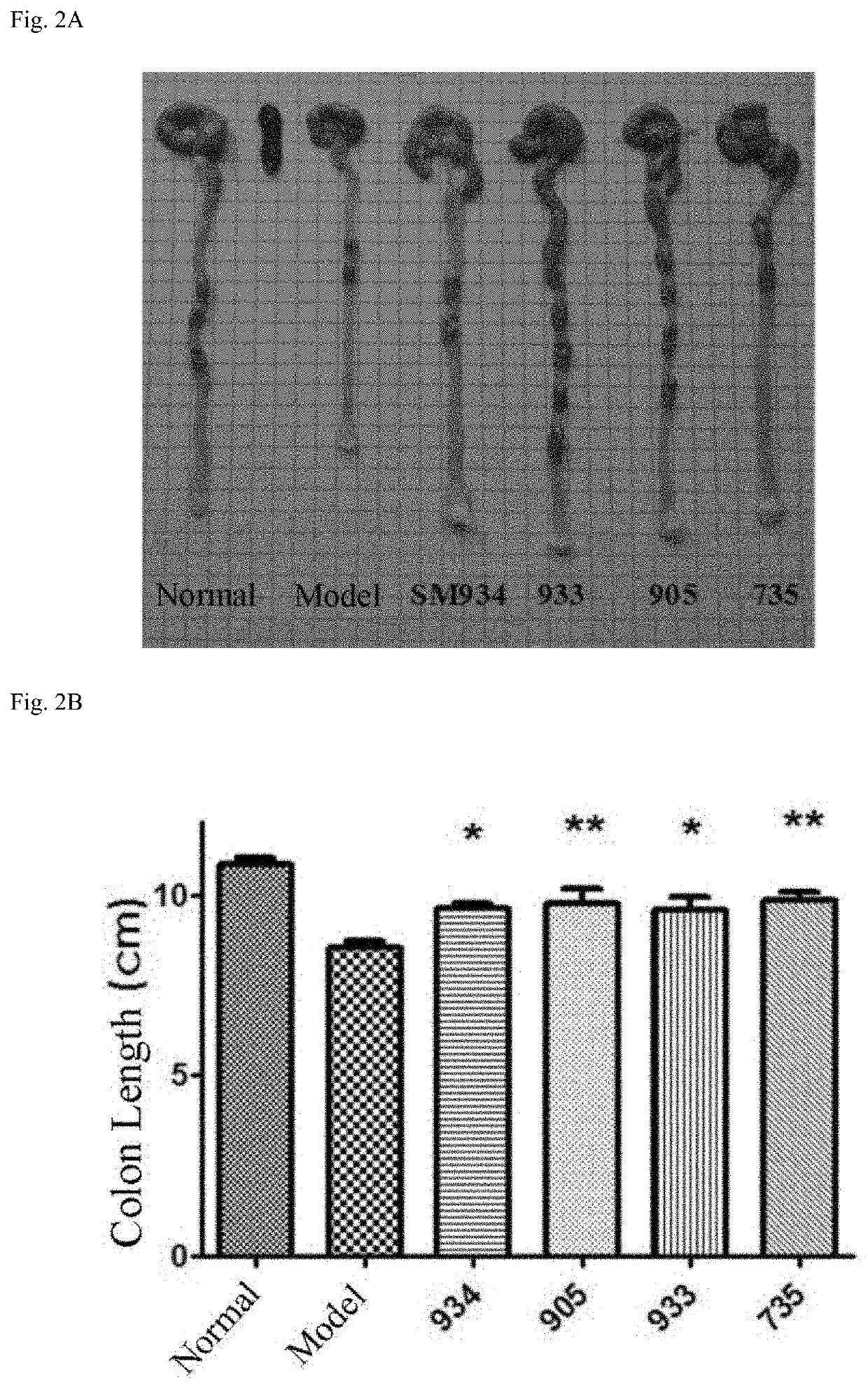 Medical use of artemisinin derivative for treating inflammatory bowel disease