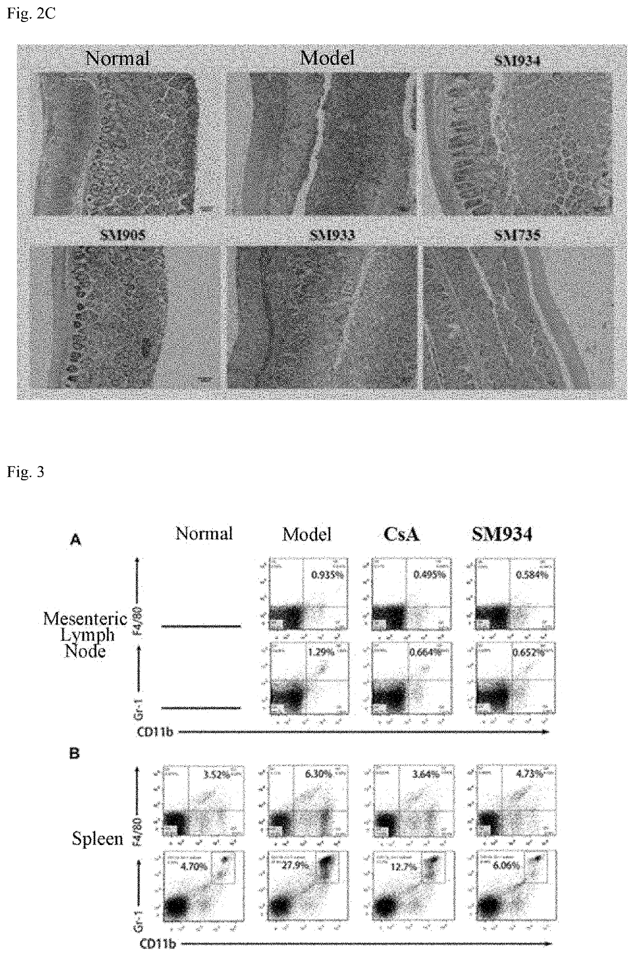 Medical use of artemisinin derivative for treating inflammatory bowel disease