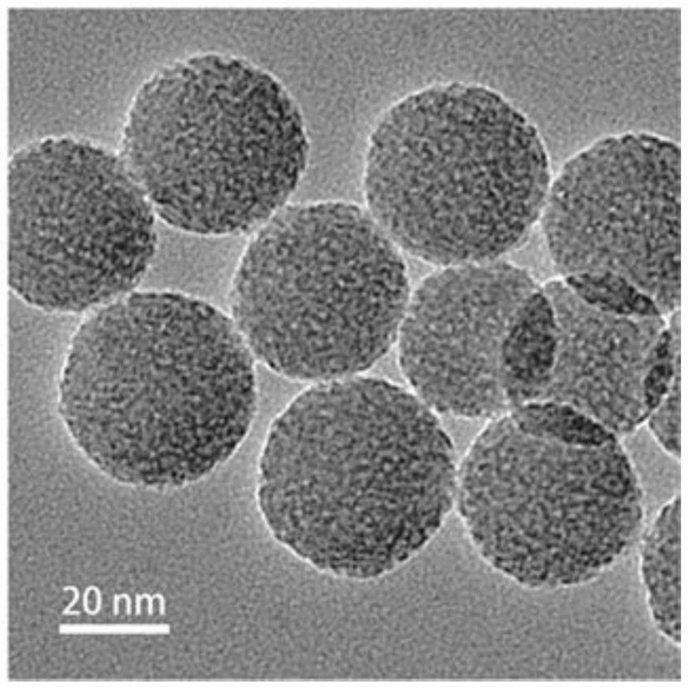 Ion-specific filter membrane/mesoporous silicon composite materials, nanosensors and their products and applications