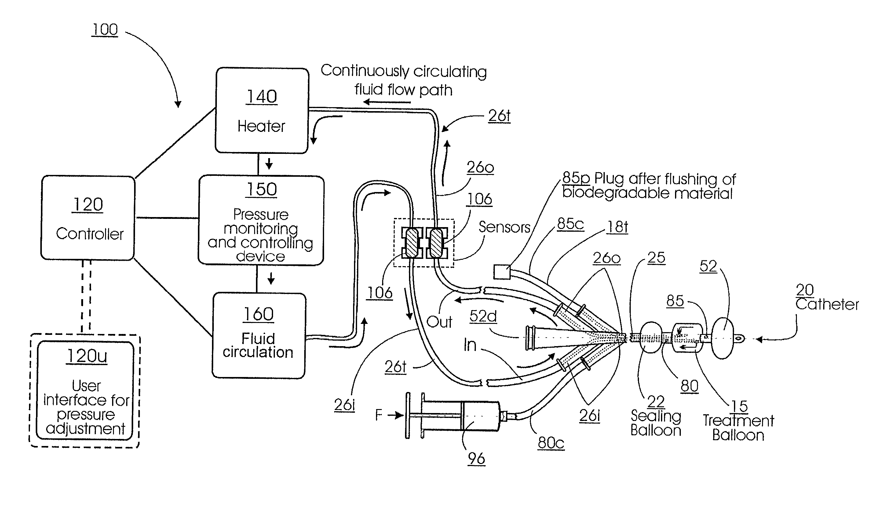 Methods for treating the prostate and inhibiting obstruction of the prostatic urethra using biodegradable stents