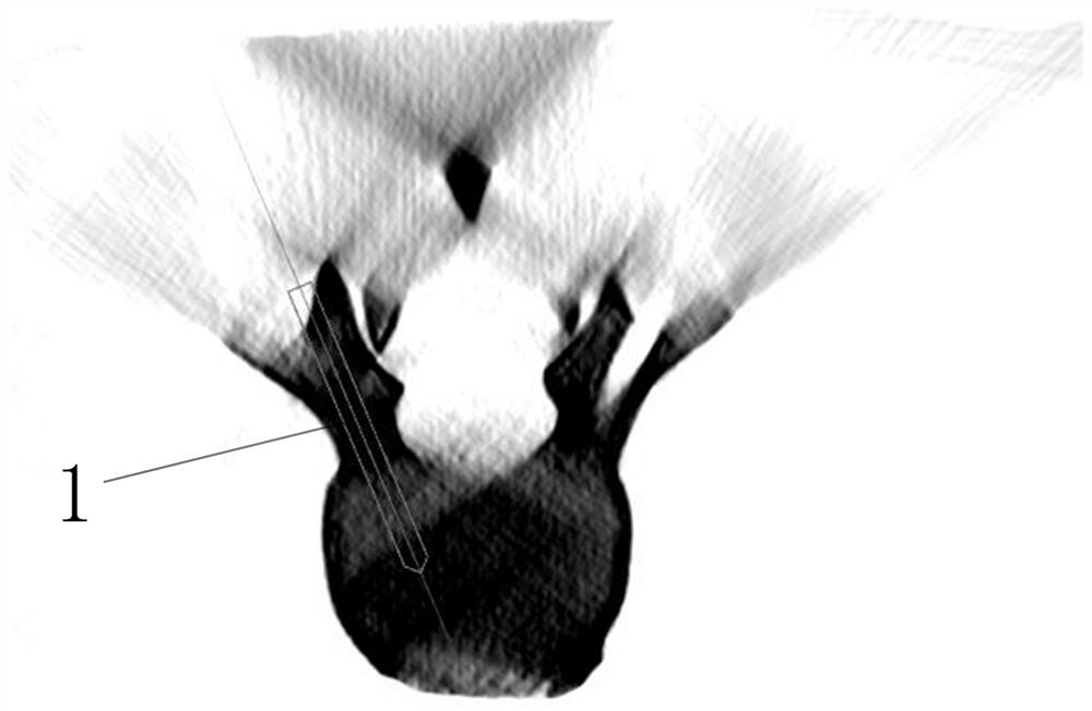 A method for evaluating the accuracy of guide needle placement