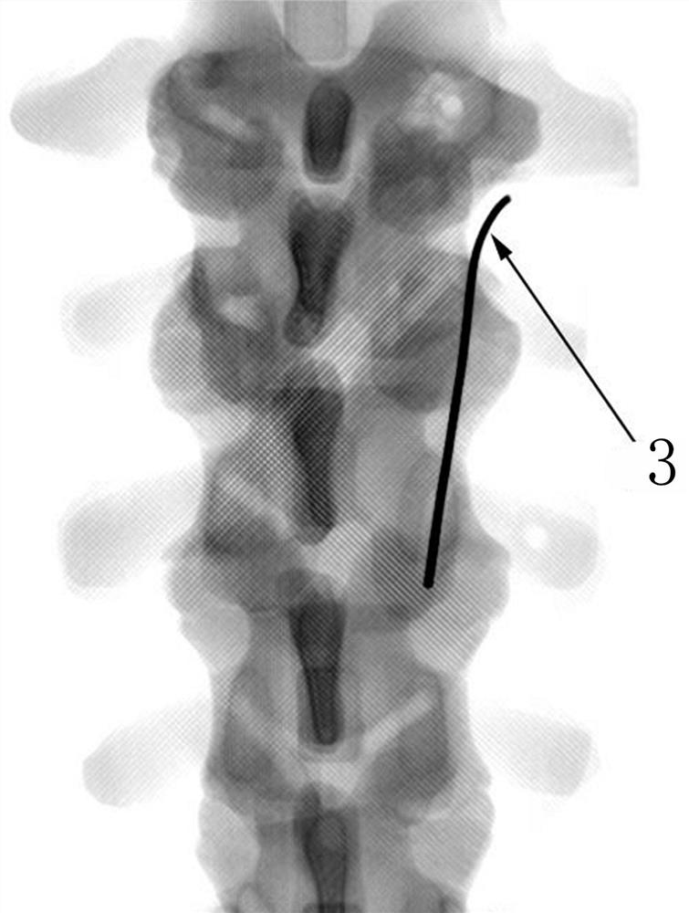 A method for evaluating the accuracy of guide needle placement