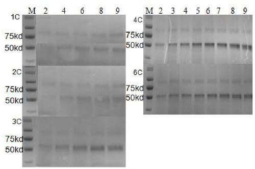 Acidic mammal chitinase coding gene and application