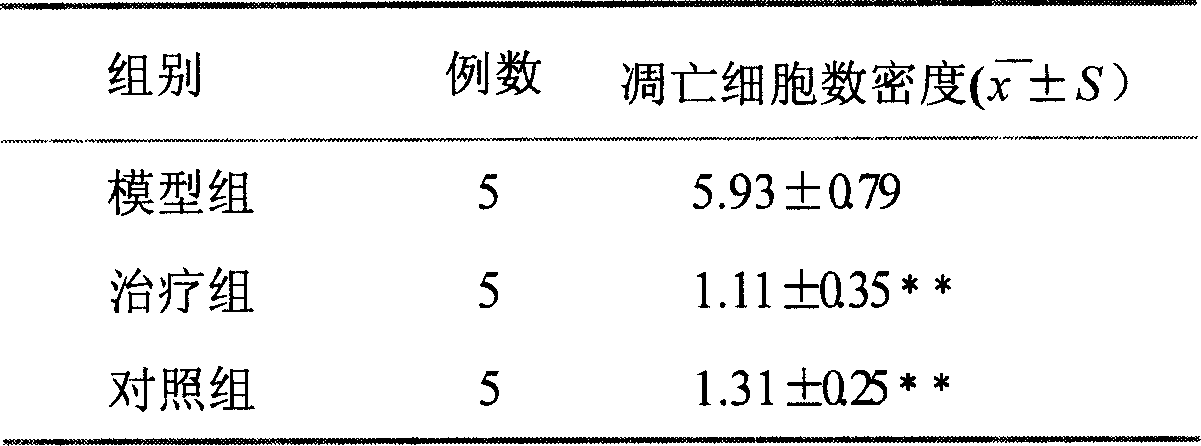 Chinese medicine preparation for treating hepatitis and anti-fulminant hepatitis, and its preparing method and use