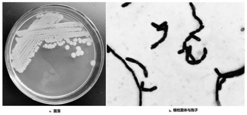 A greening bacteria agent for increasing the chlorophyll content of green leafy vegetables and its preparation method and application