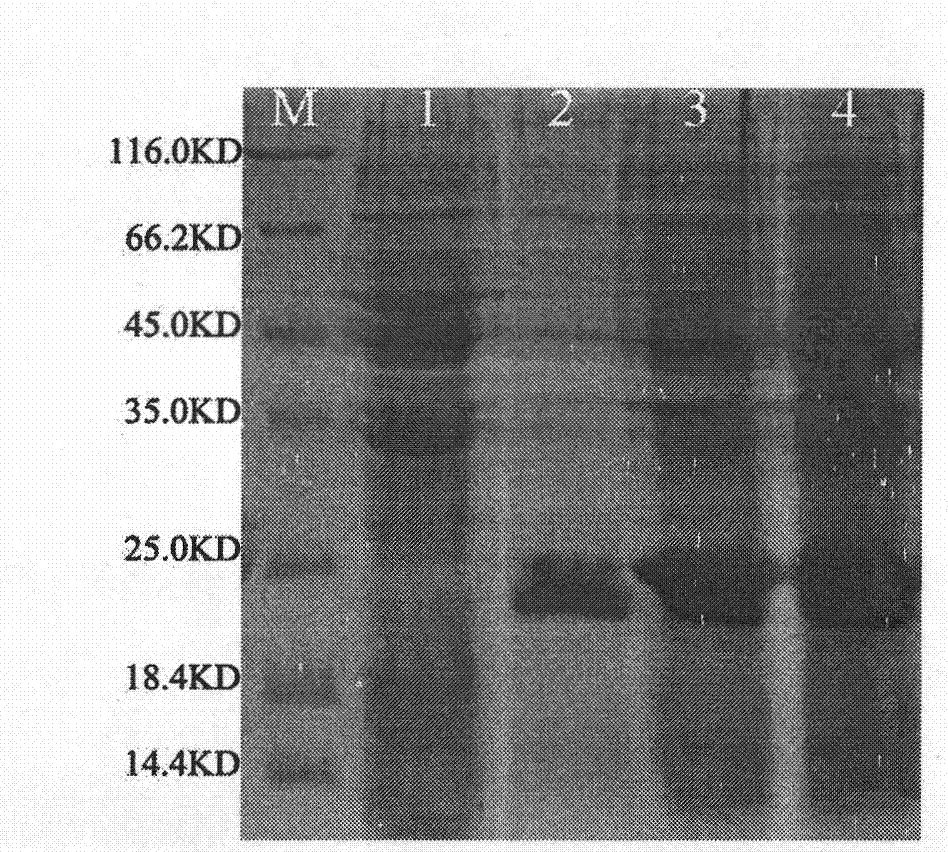 Artificial sequence for increasing methionine content of soy and plant expression vector thereof