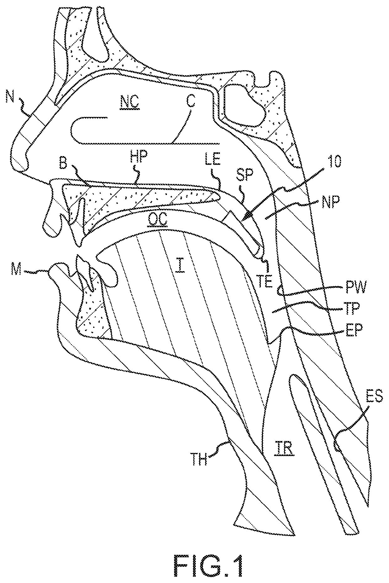 Method and System for Preventing Sore Throat in Humans