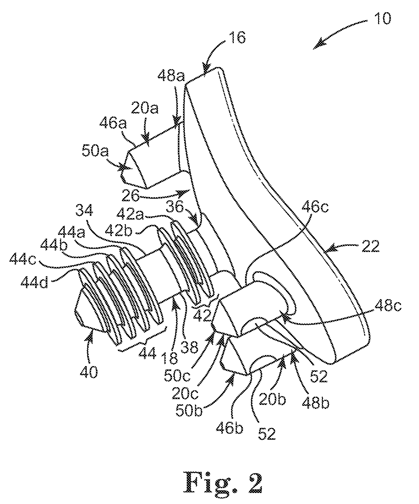 Glenoid implant anchor post