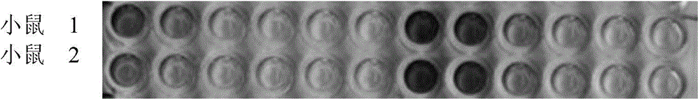 Avian metapneumovirus (aMPV) F protein polypeptide and application thereof