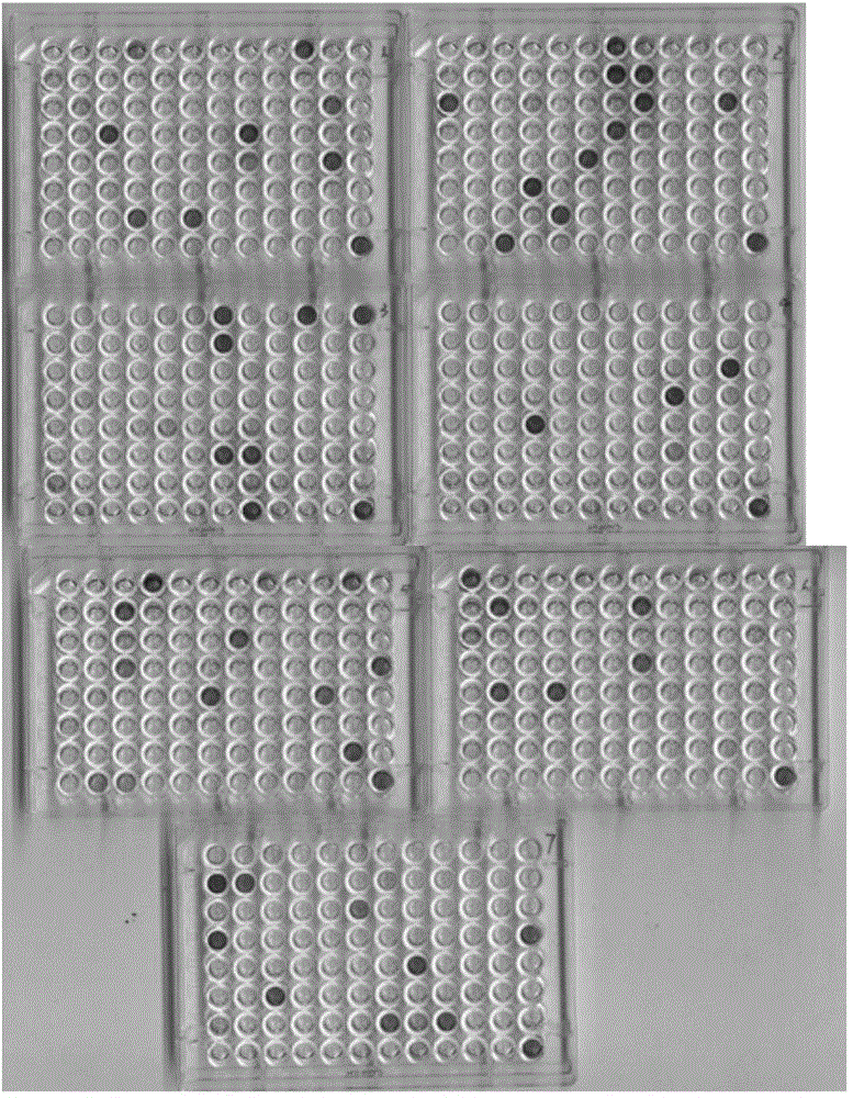 Avian metapneumovirus (aMPV) F protein polypeptide and application thereof