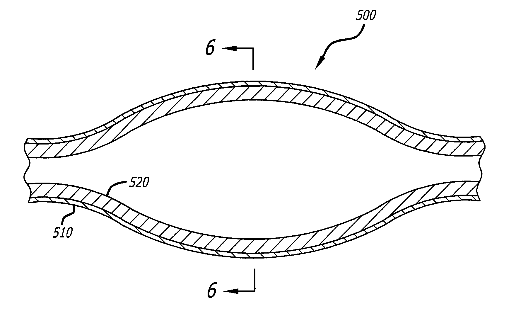 Robust multi-layer balloon