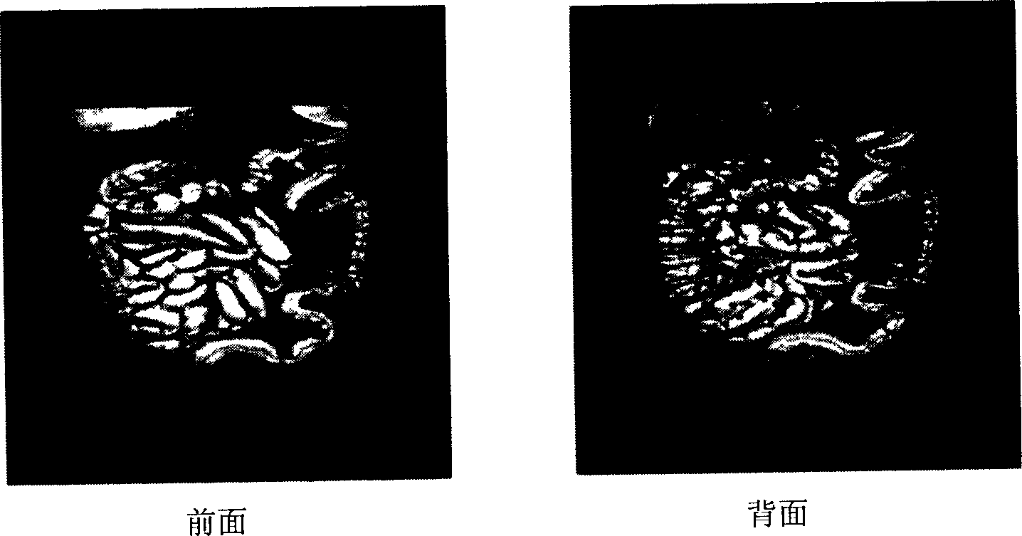 Center line automatic locating method of virtual endoscope system