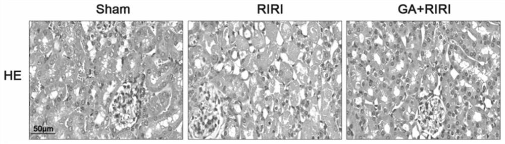 Application of gambogic acid in preparation of medicine for preventing or treating kidney ischemia-reperfusion injury