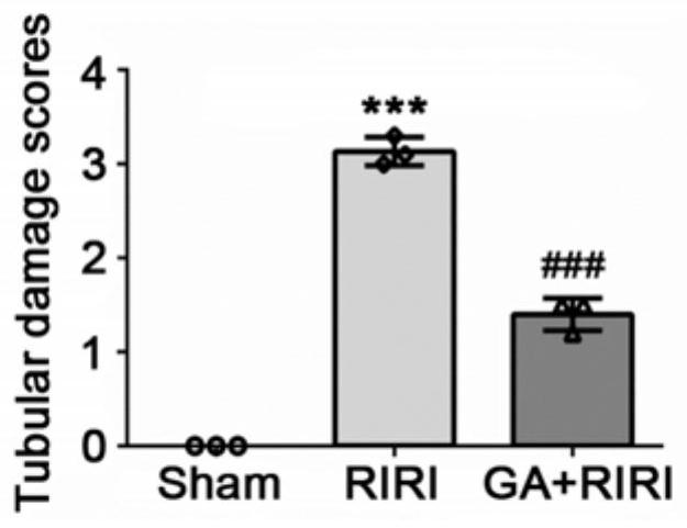 Application of gambogic acid in preparation of medicine for preventing or treating kidney ischemia-reperfusion injury