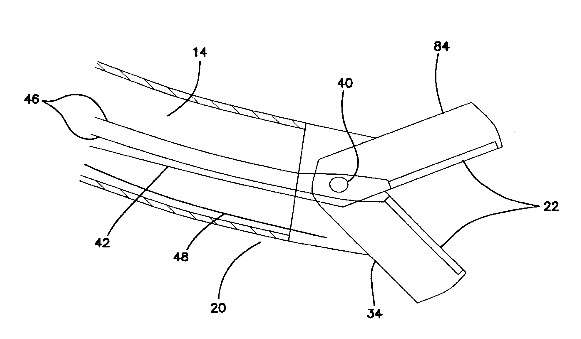 Systems and methods for percutaneous intravascular access for arteriovenous fistula