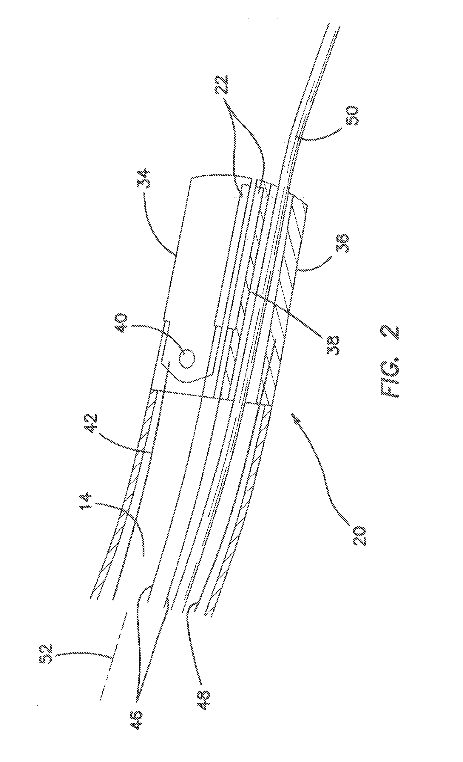 Systems and methods for percutaneous intravascular access for arteriovenous fistula