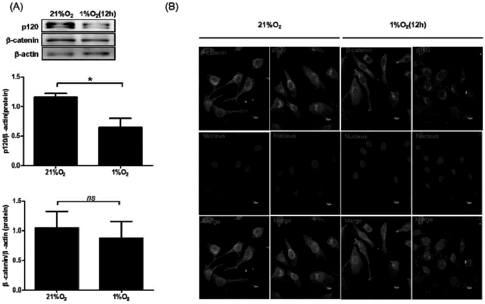 Application of sodium butyrate in preventing and curing high permeability of blood vessels and relevant diseases