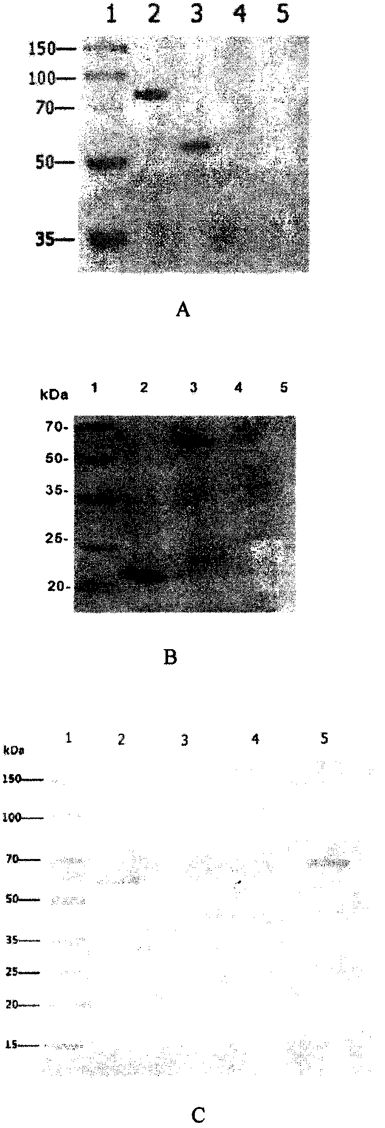 Use of carrier peptides for linking B epitope or semiantigen and immunogen containing carrier peptide in medicine and immunology