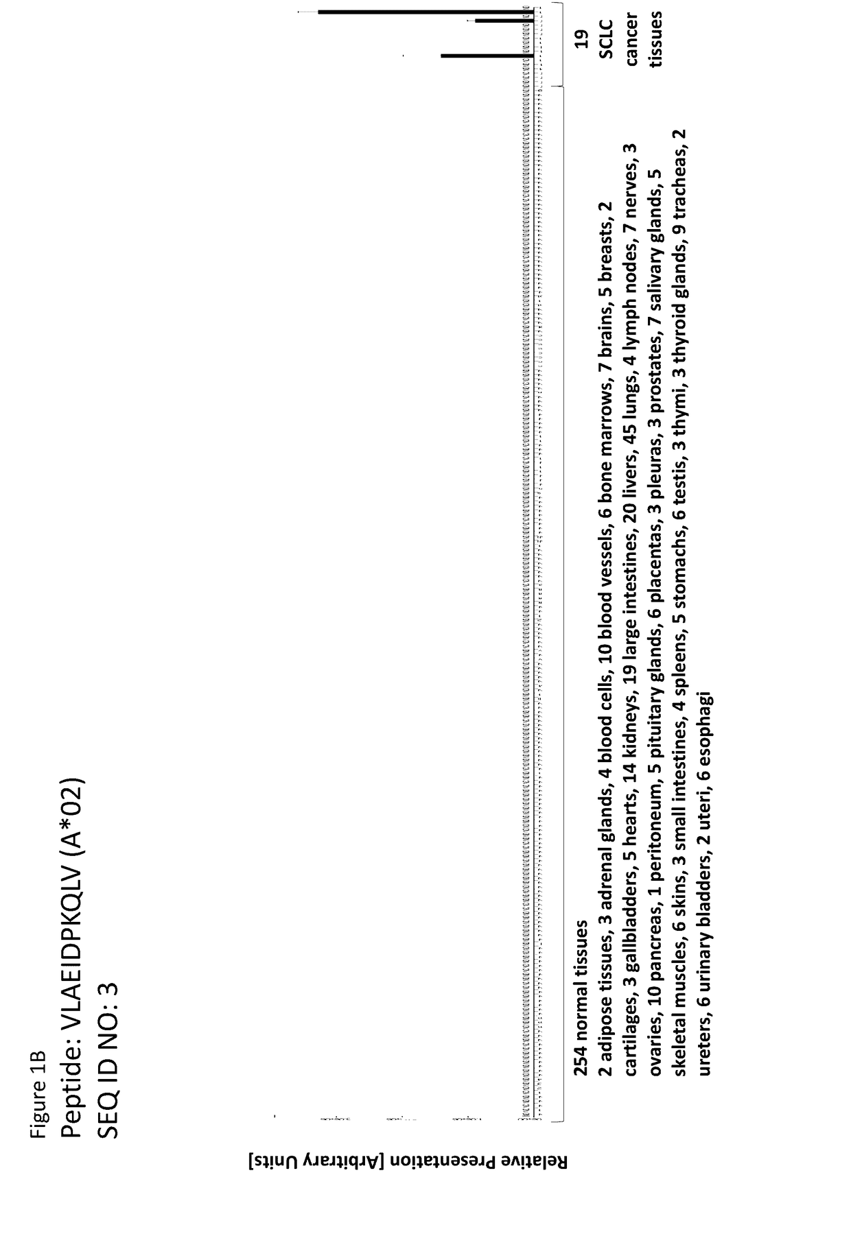 Novel peptides and combination of peptides for use in immunotherapy against small cell lung cancer and other cancers