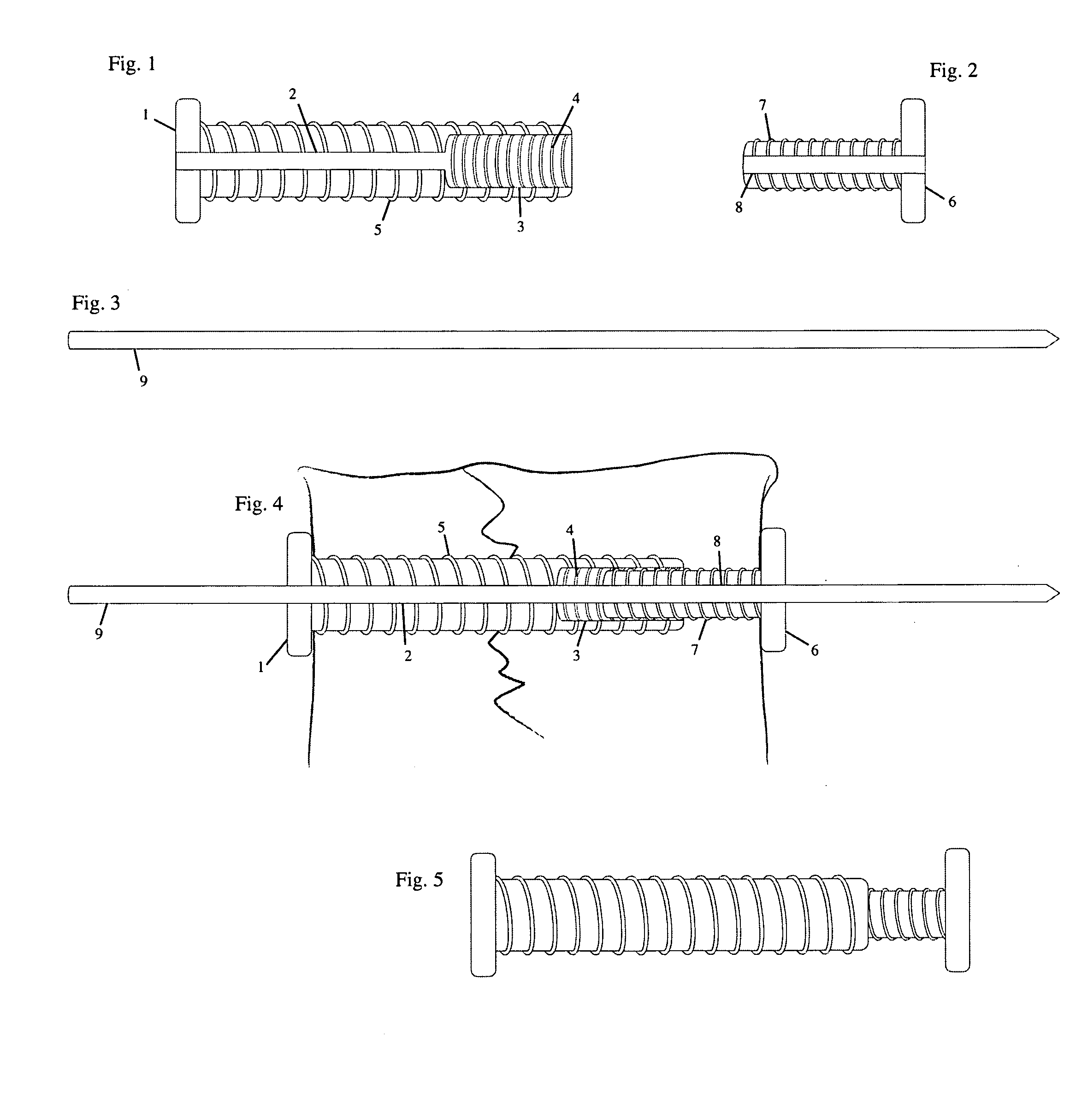 Connecting Cannulated Bone Screws