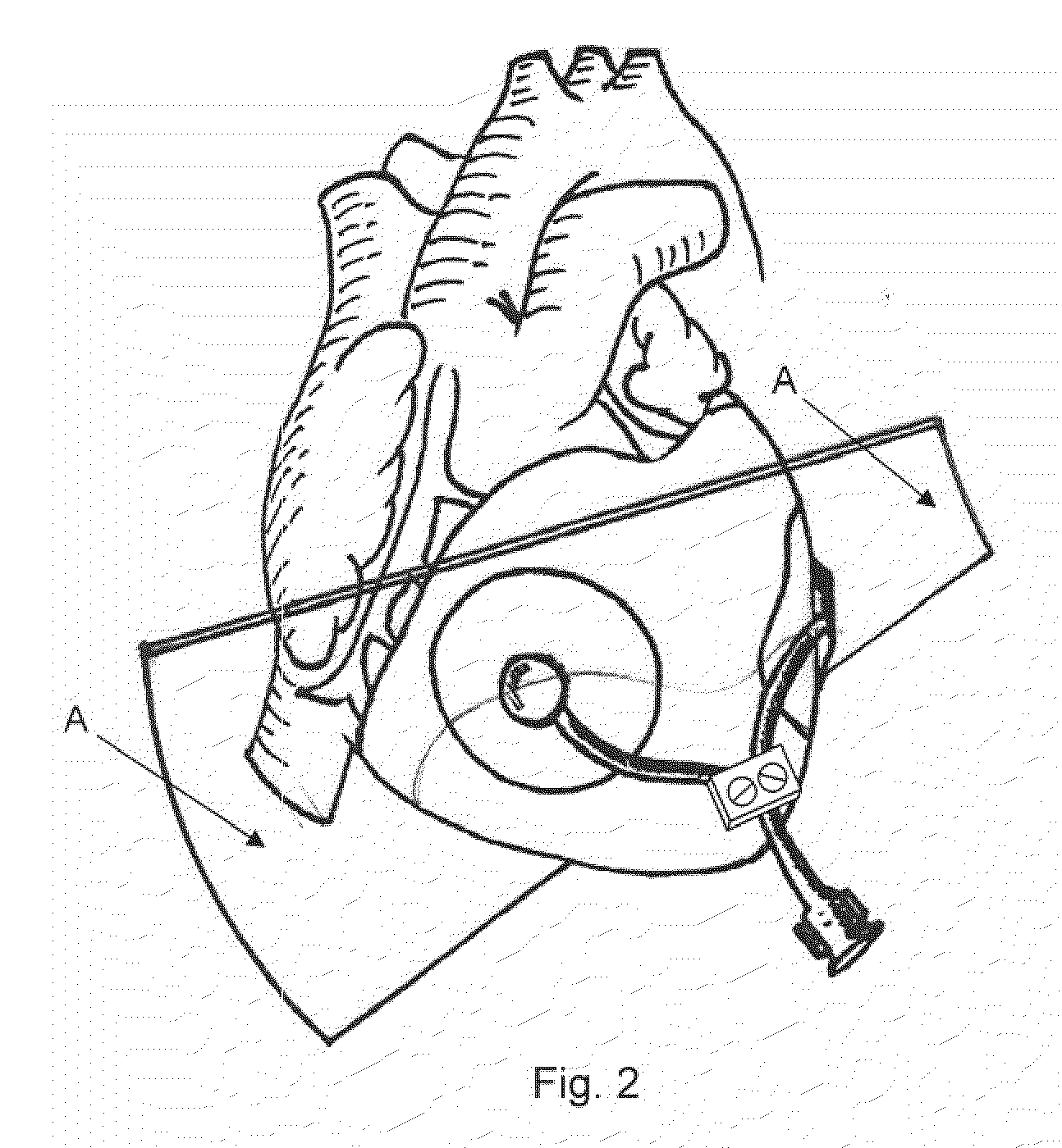 Cardiac Compression System