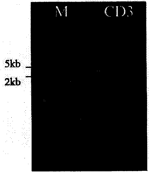 Chitinase capable of degrading spore walls of myxosporean and encoding genes thereof