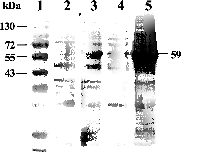 Xinjiang hemorrhagic fever virus immunochromatography fast detection test paper