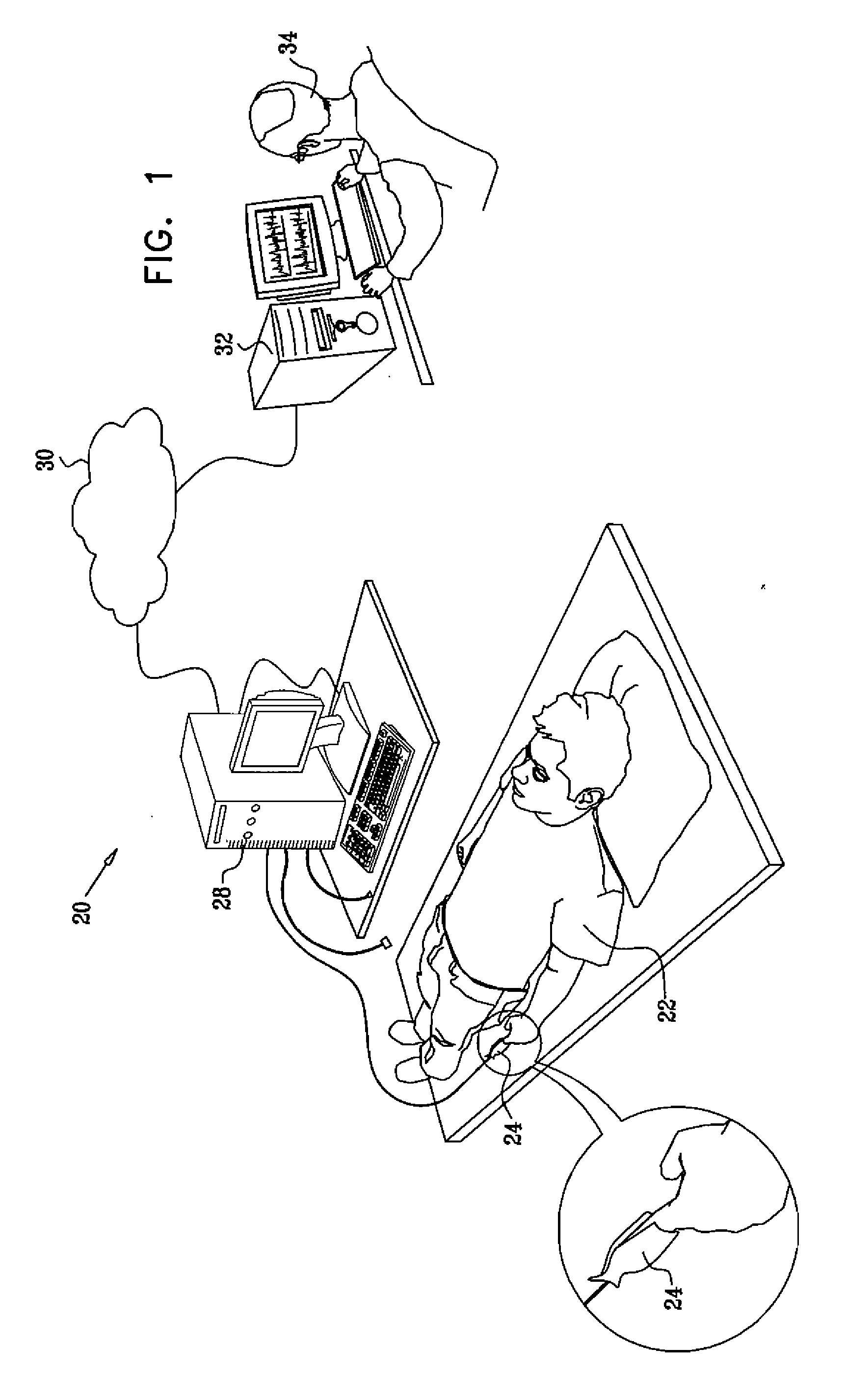 Detection of heart failure using a photoplethysmograph