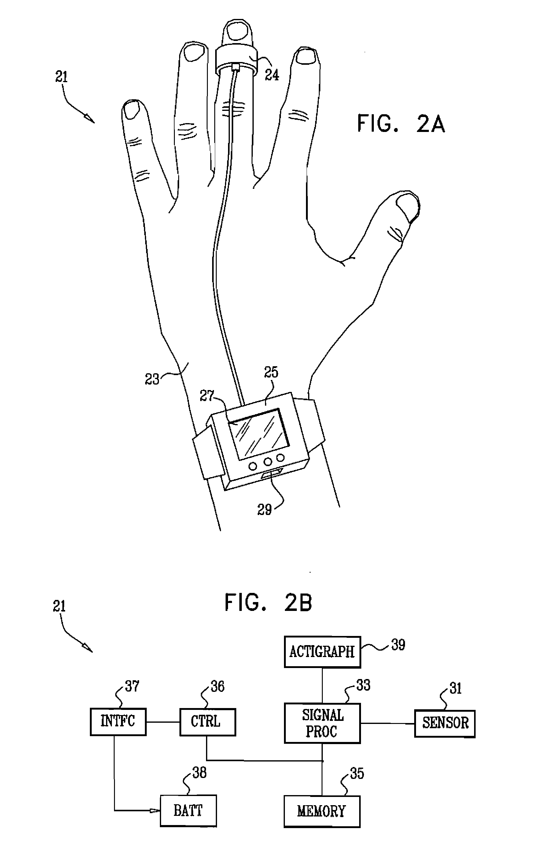 Detection of heart failure using a photoplethysmograph