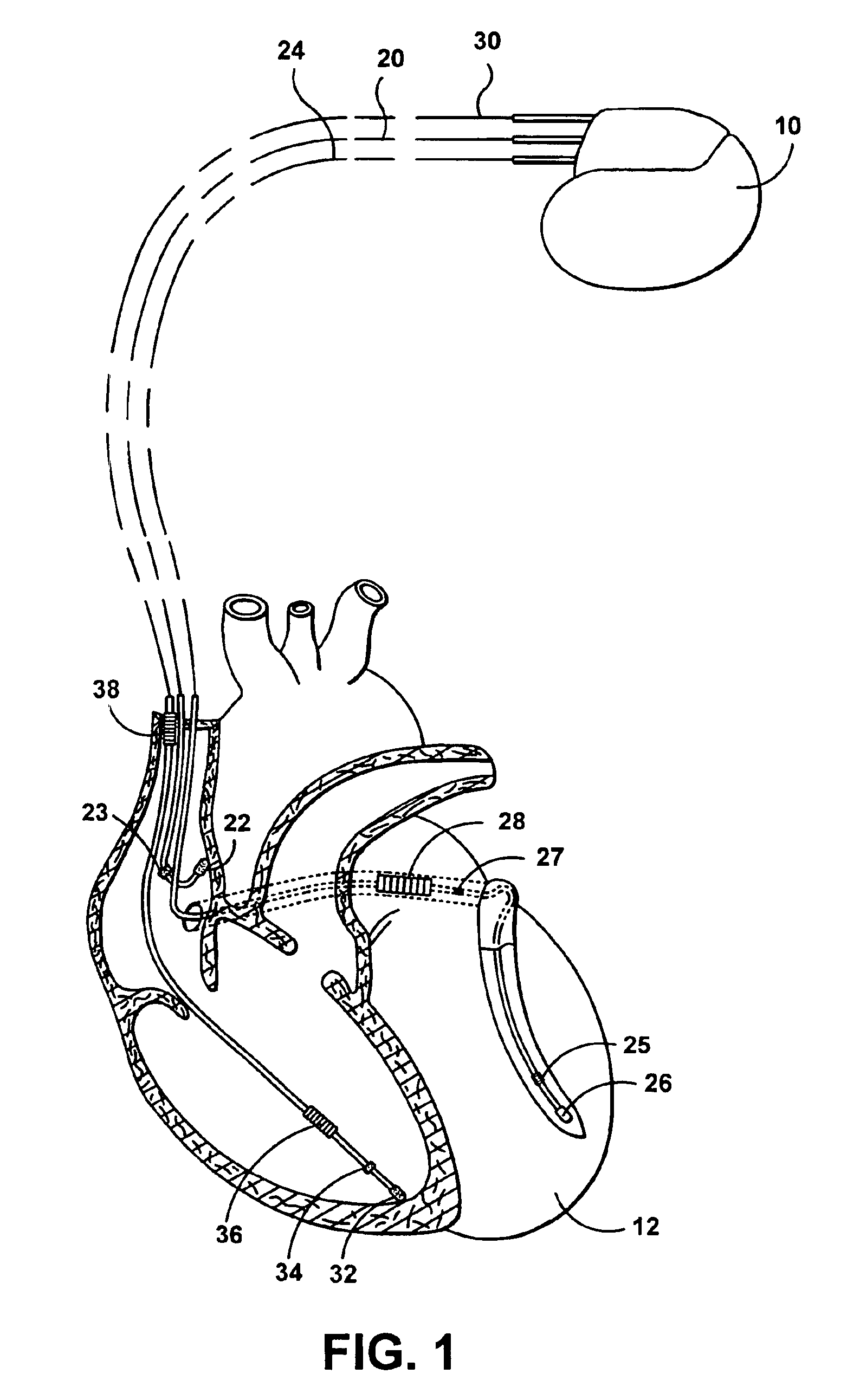 System and method with improved automatic testing functions for defining capture thresholds