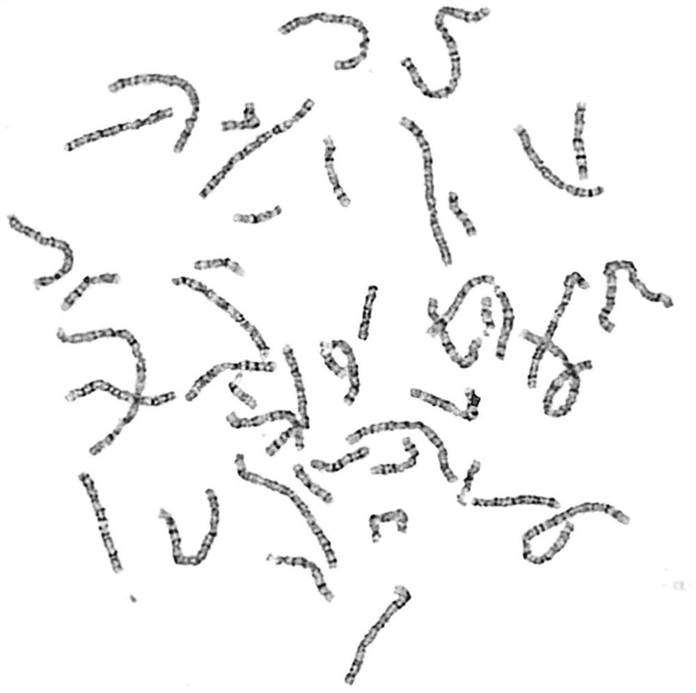 Special preparation of high-resolution chromosome staining solution for karyotype analysis