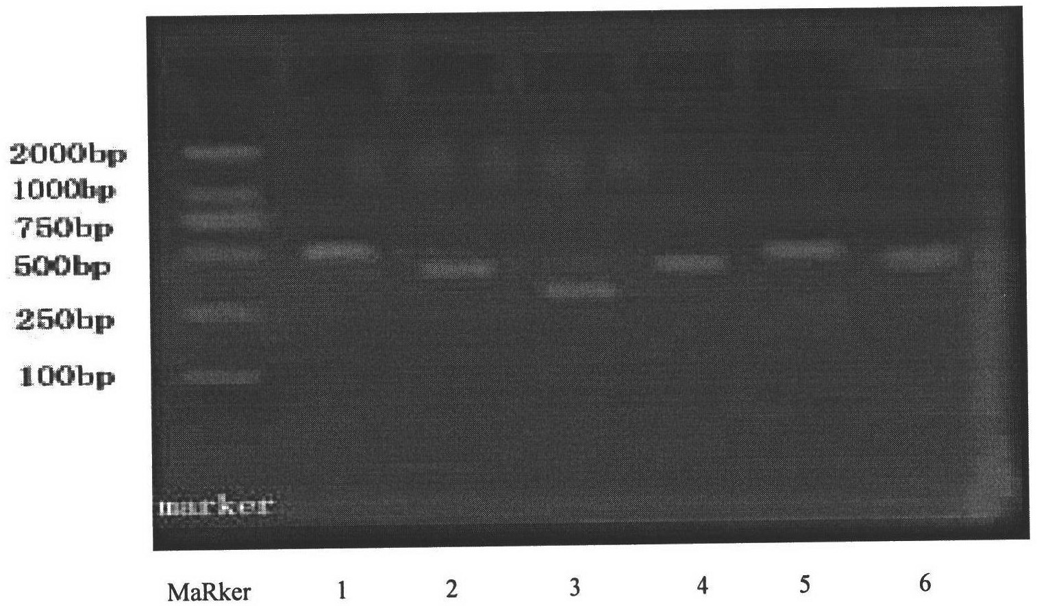 Gene combination used for guiding individual treatment of platinum medicines