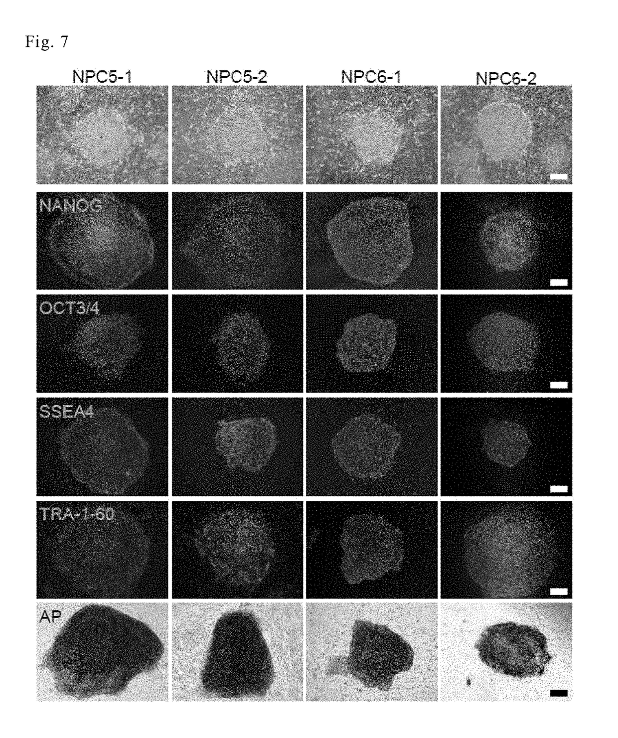 Drug for the treatment of cholesterol accumulation disorders, and screening method for same