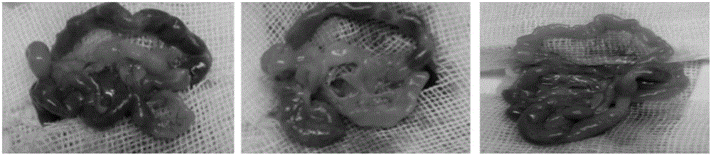 Colorectal cancer peritoneal metastasis model and establishment method thereof