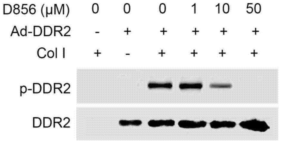 Anti-pulmonary fibrosis application of DDR2 small-molecule inhibitor