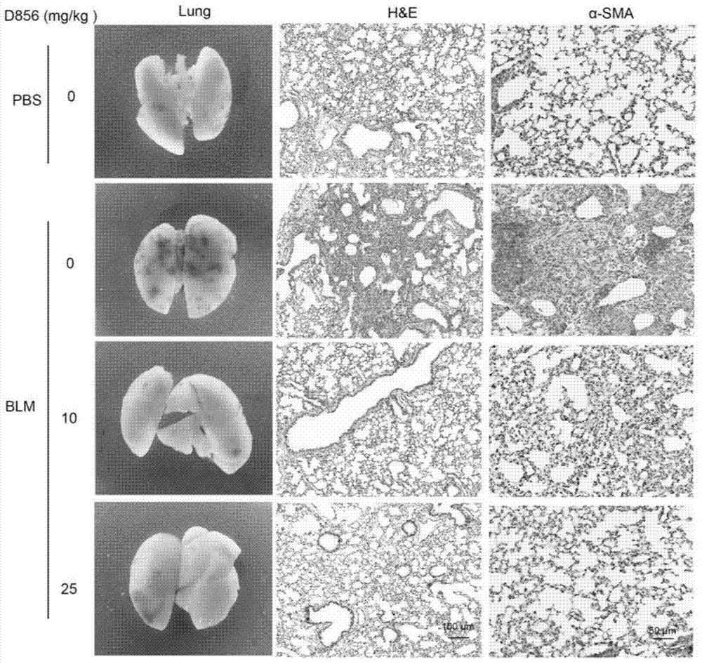 Anti-pulmonary fibrosis application of DDR2 small-molecule inhibitor