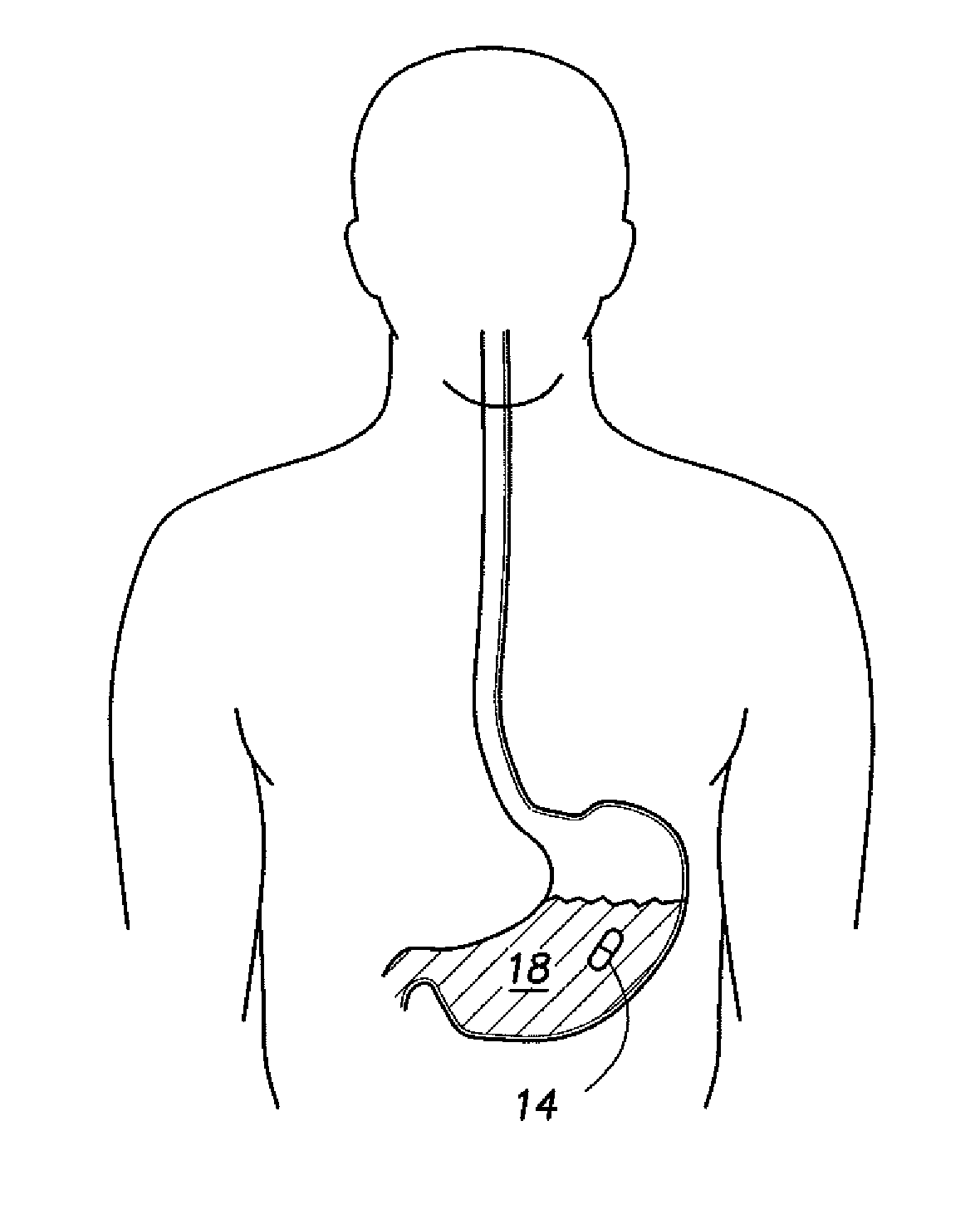 Communication system incorporated in an ingestible product