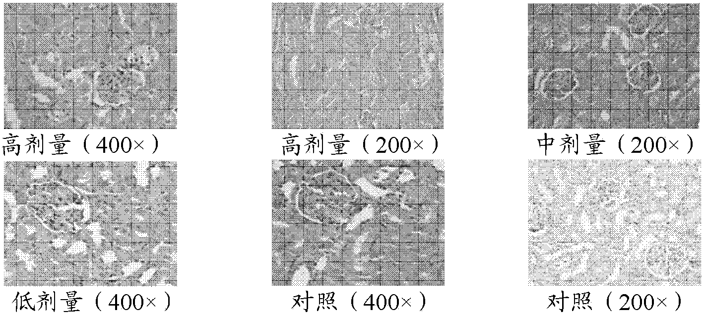 Rheum officinale anthraquinone oral colon targeted drug delivery composition and application thereof