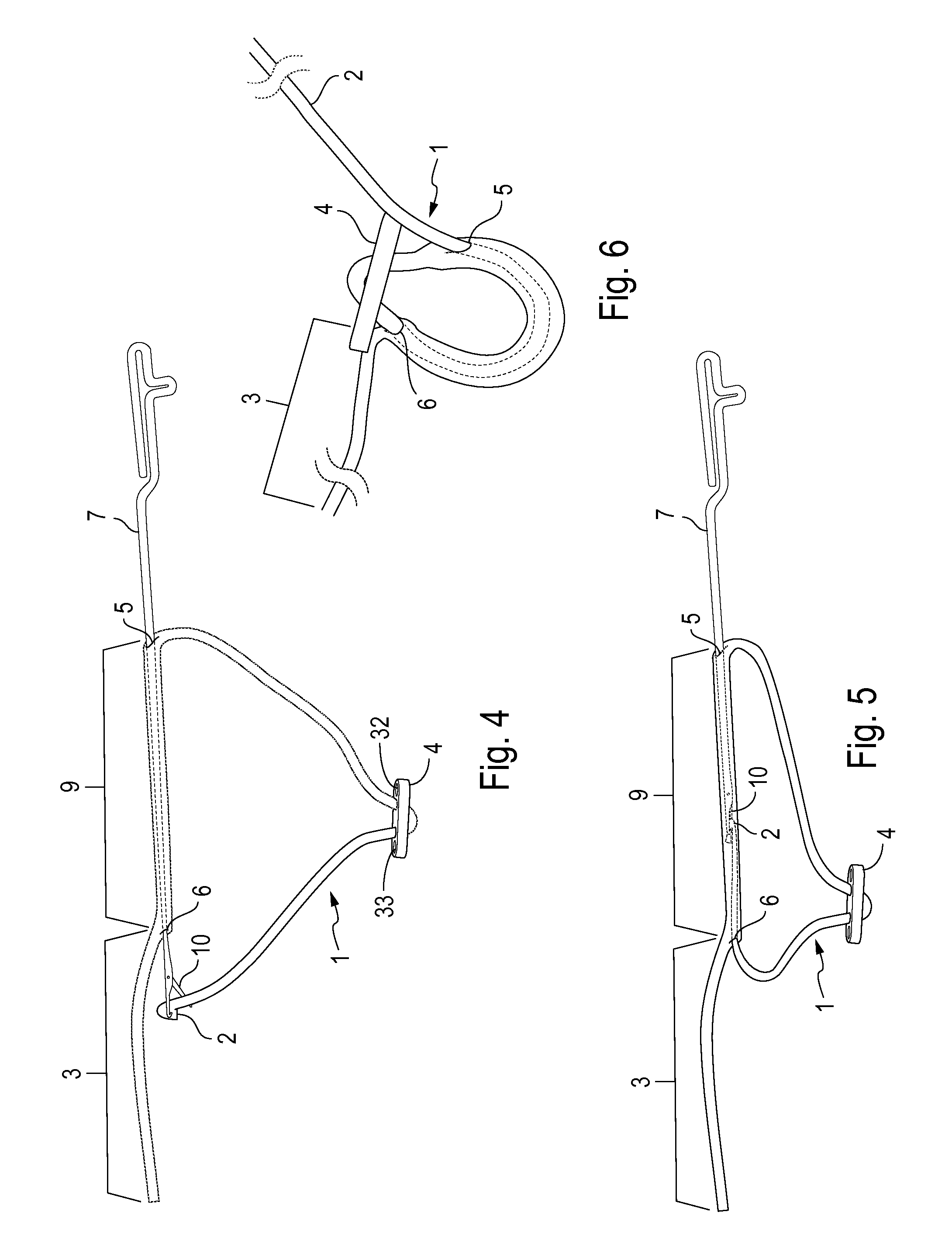 Continuous Loop and Button Assembly