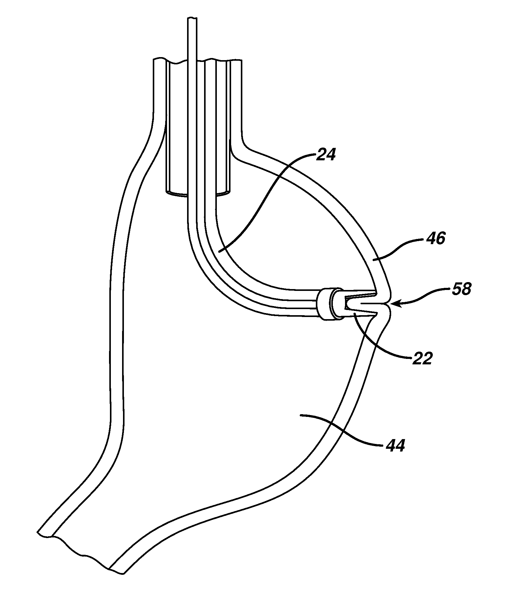 Device for plicating and fastening gastric tissue