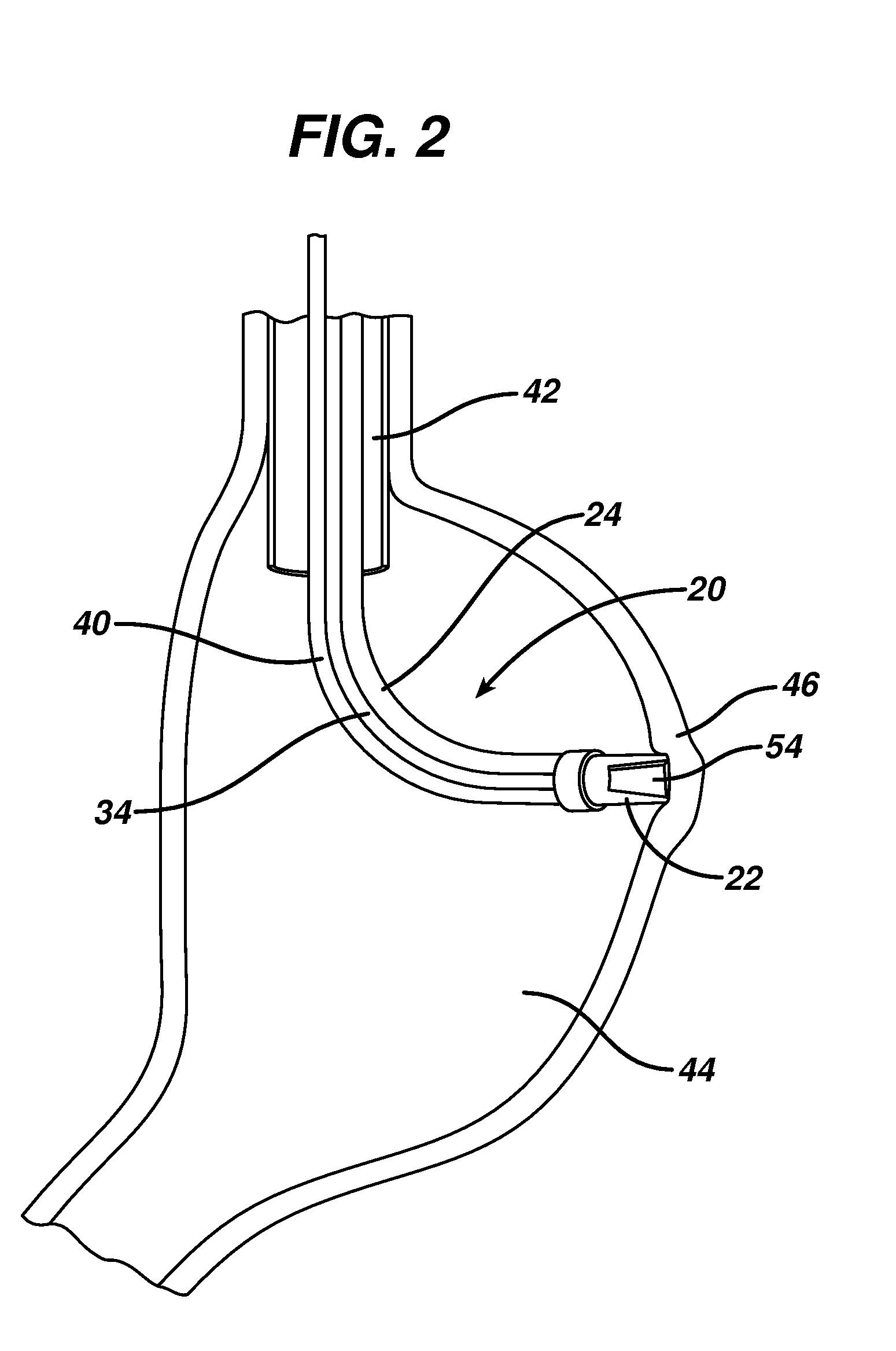 Device for plicating and fastening gastric tissue