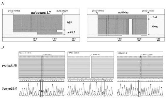 Method and kit for simultaneously detecting multiple mutations of HBA1/2 and HBB gene loci