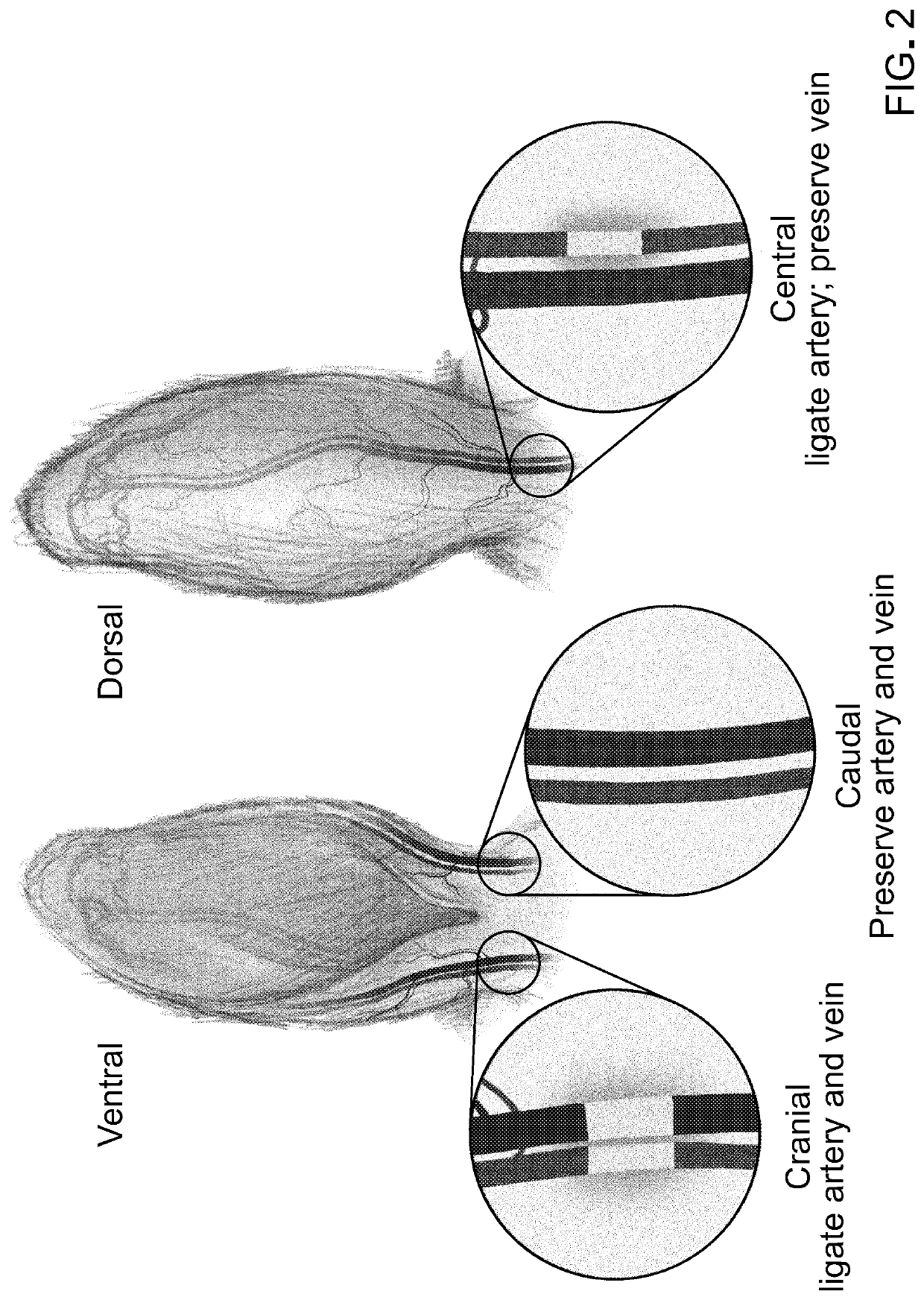 Methods and materials for reducing scar formation during wound healing