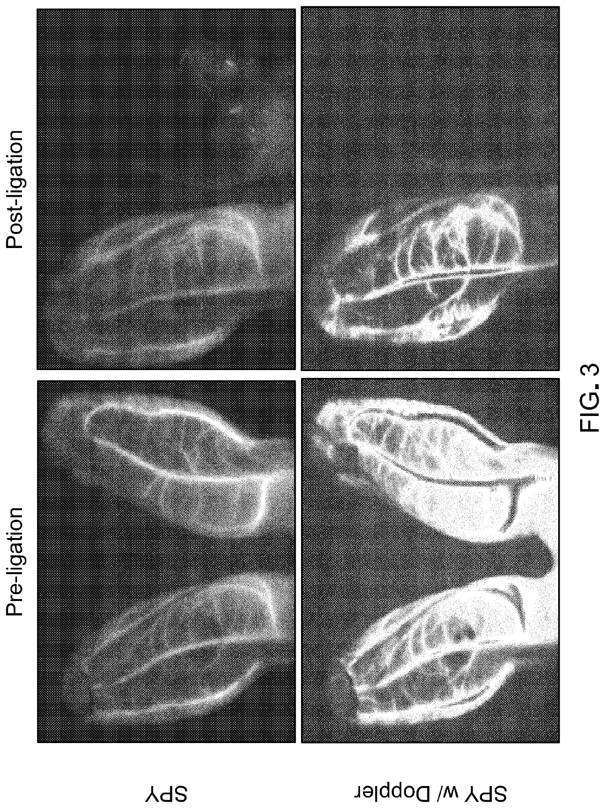 Methods and materials for reducing scar formation during wound healing