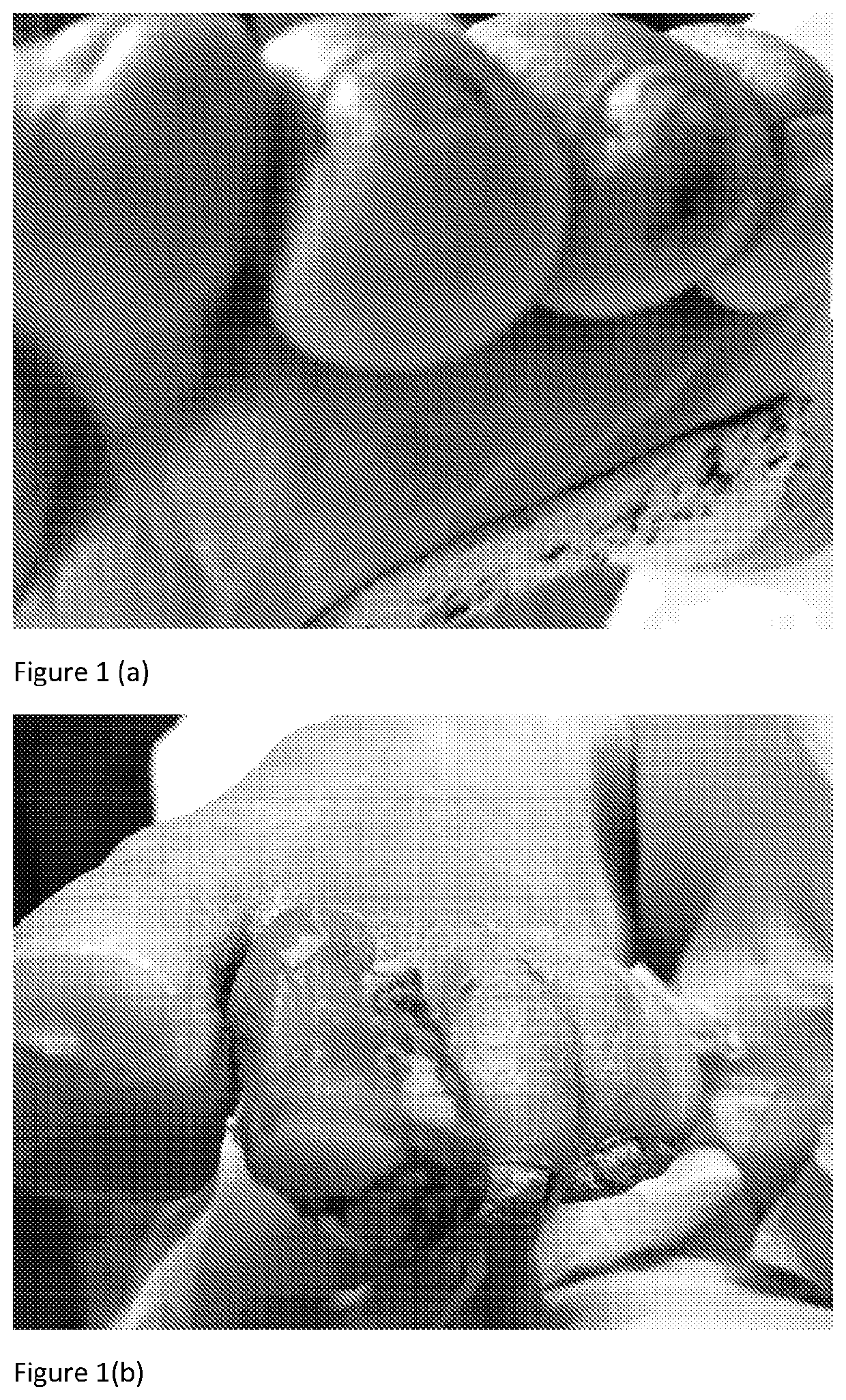 Composition for treatment of chronic wounds