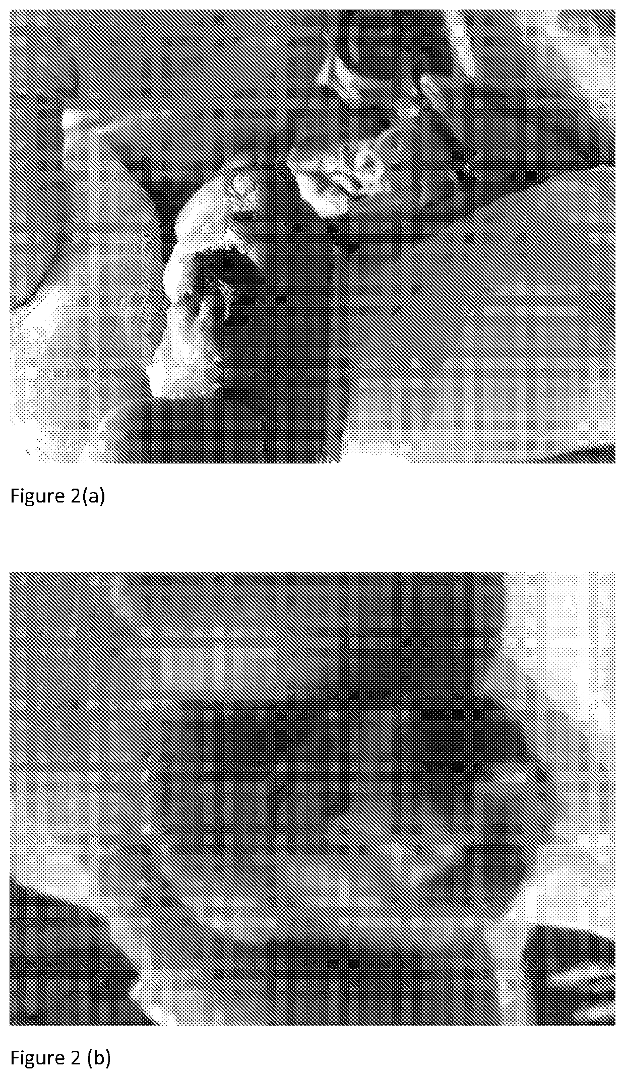 Composition for treatment of chronic wounds