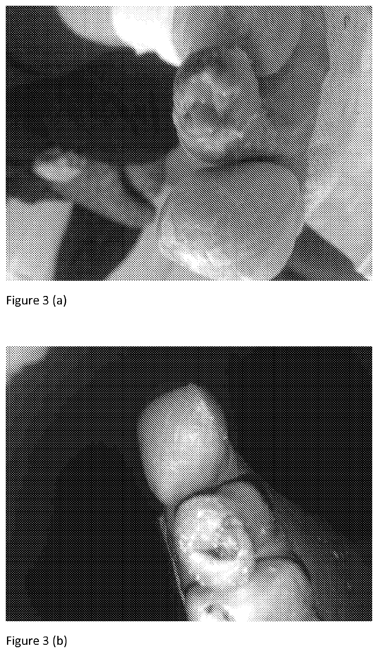 Composition for treatment of chronic wounds