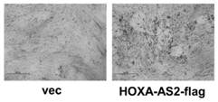 Application of long non-coding RNA-hoxa-as2 in the repair of bone tissue damage