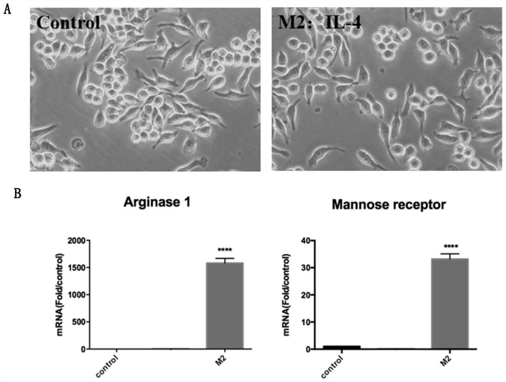 Application of M2 type macrophage exosome in preparation of medicine for treating osteoporosis