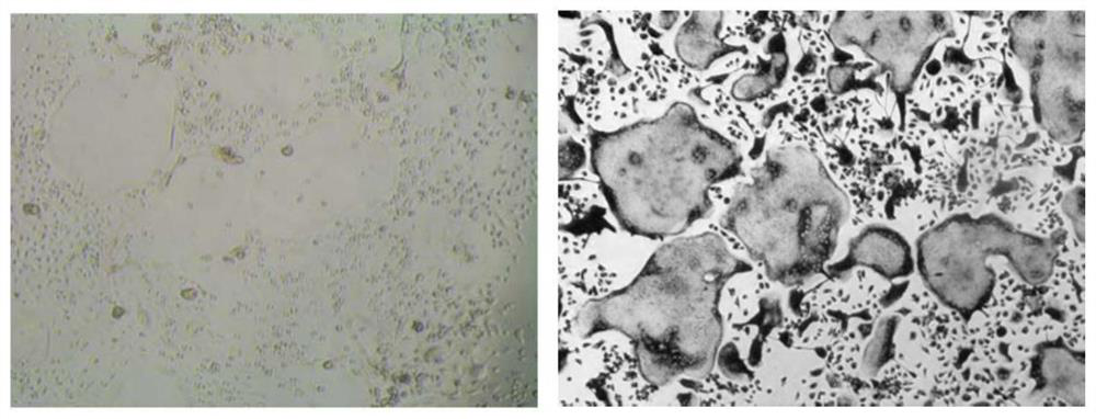 Application of M2 type macrophage exosome in preparation of medicine for treating osteoporosis